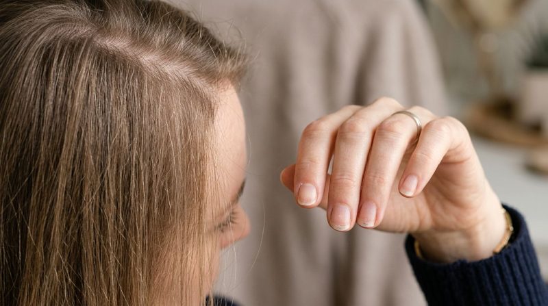 Biotientekort se simptome wat haarverlies en bros naels kan verklaar