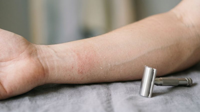 Skeeruitslag of ingroeihaartjies: minder ontsteking